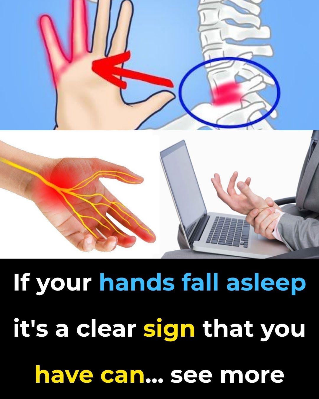 Reasons You Could Have Numbness or Tingling Sensations in Your Hands