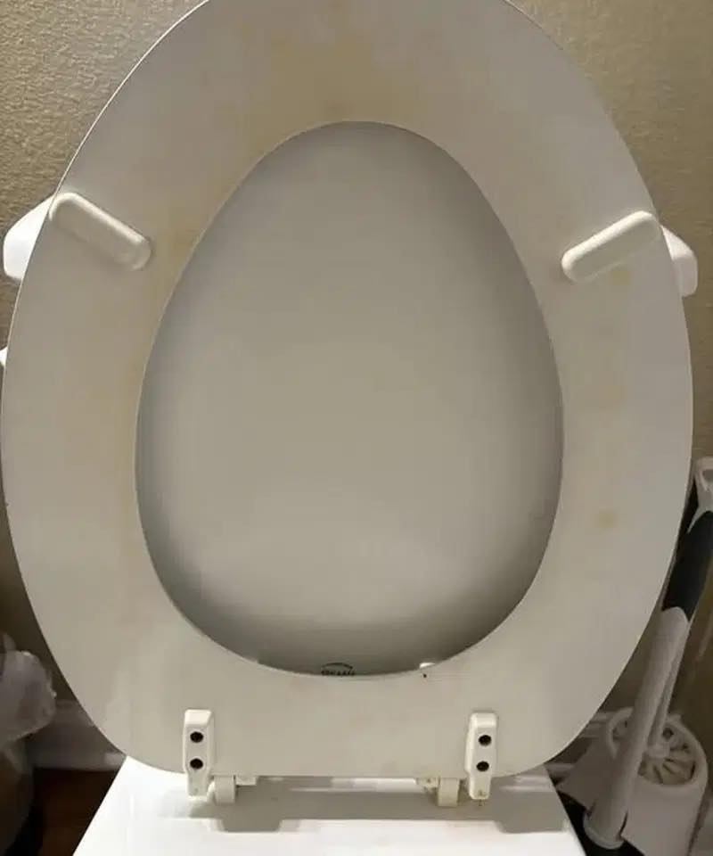 How I Got Rid of a Yellow Toilet Ring Without Replacing the Seat