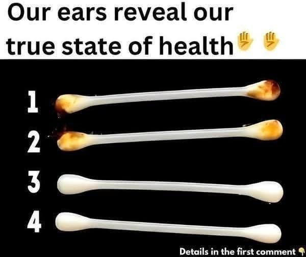 Our Ears Reveal Our True State of Health: